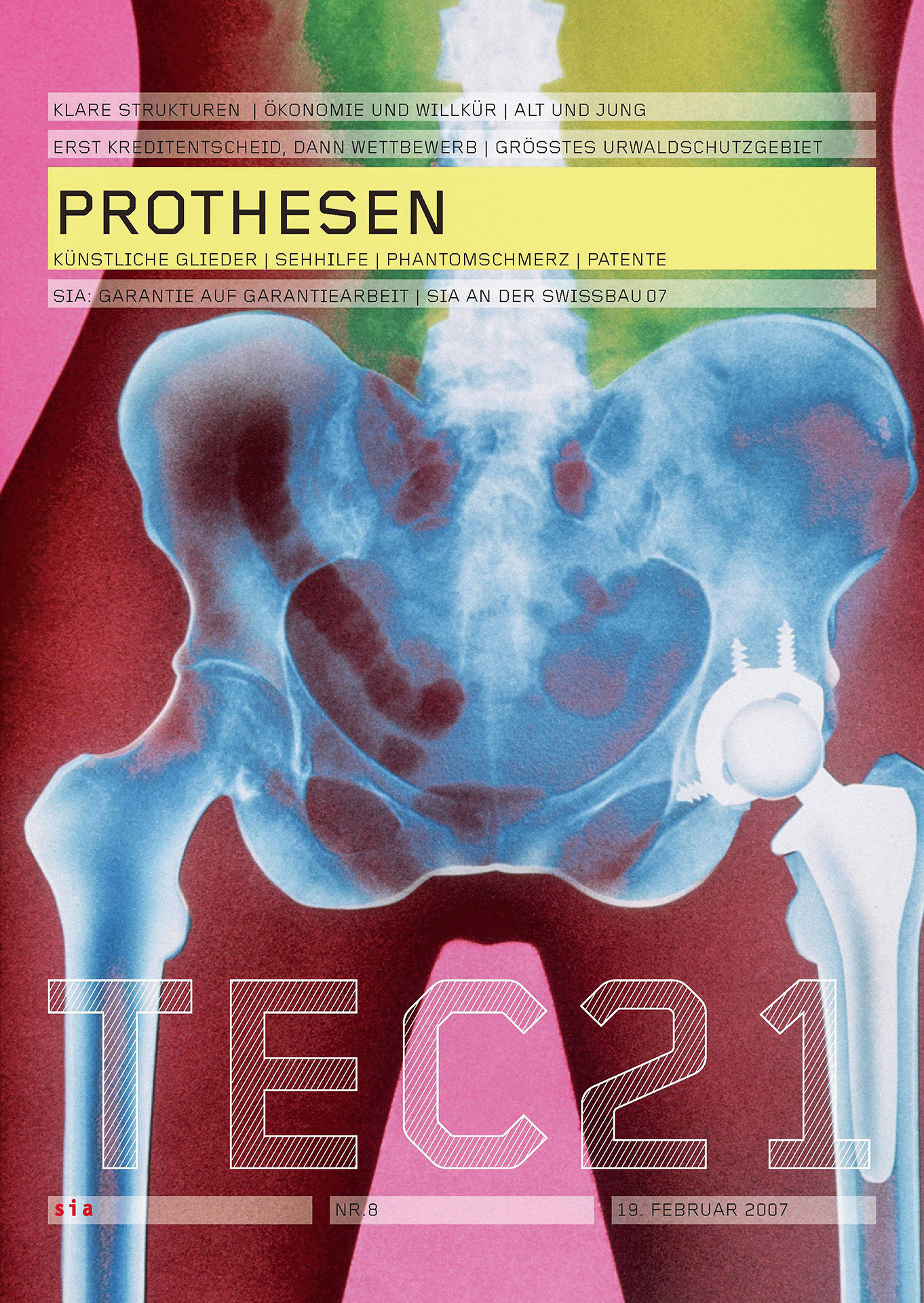 TEC21 8/2007 Prothesen